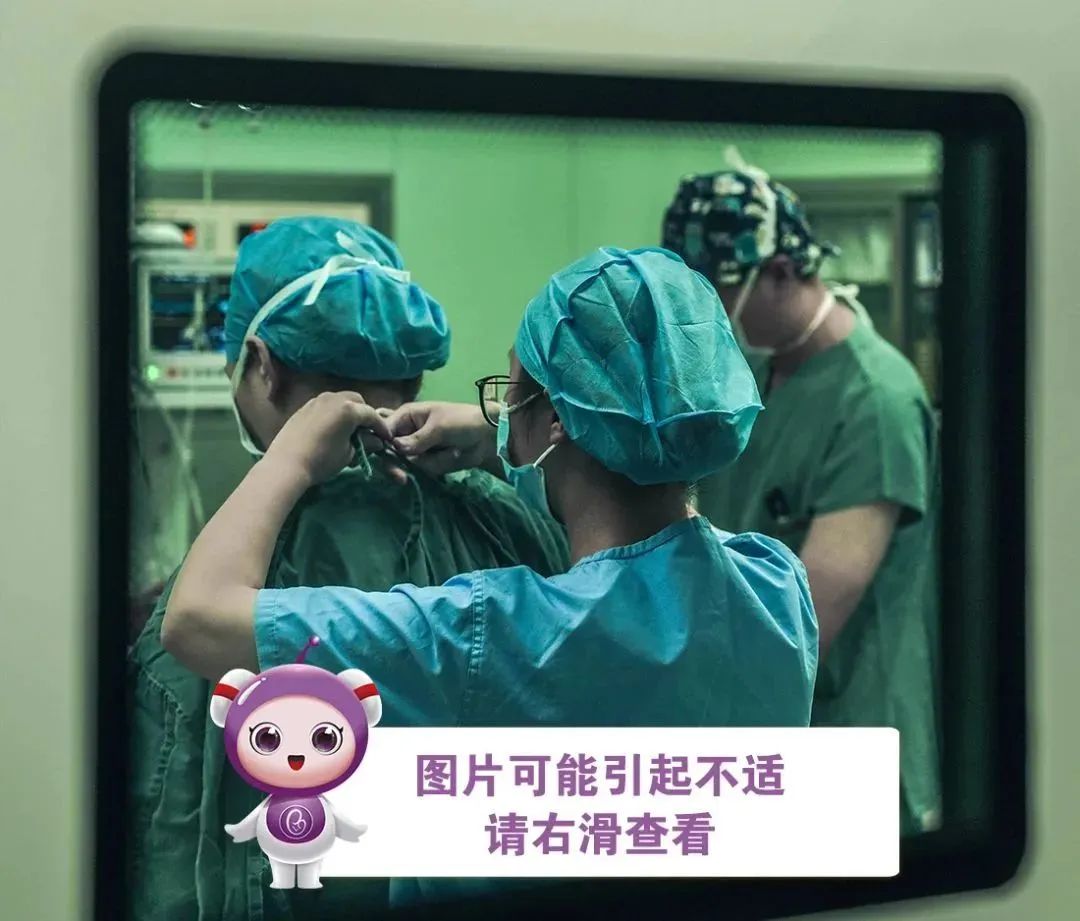 为了祛疤拼二胎？一位剖宫产妈妈的“祛疤”故事